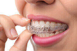 Invisalign Care