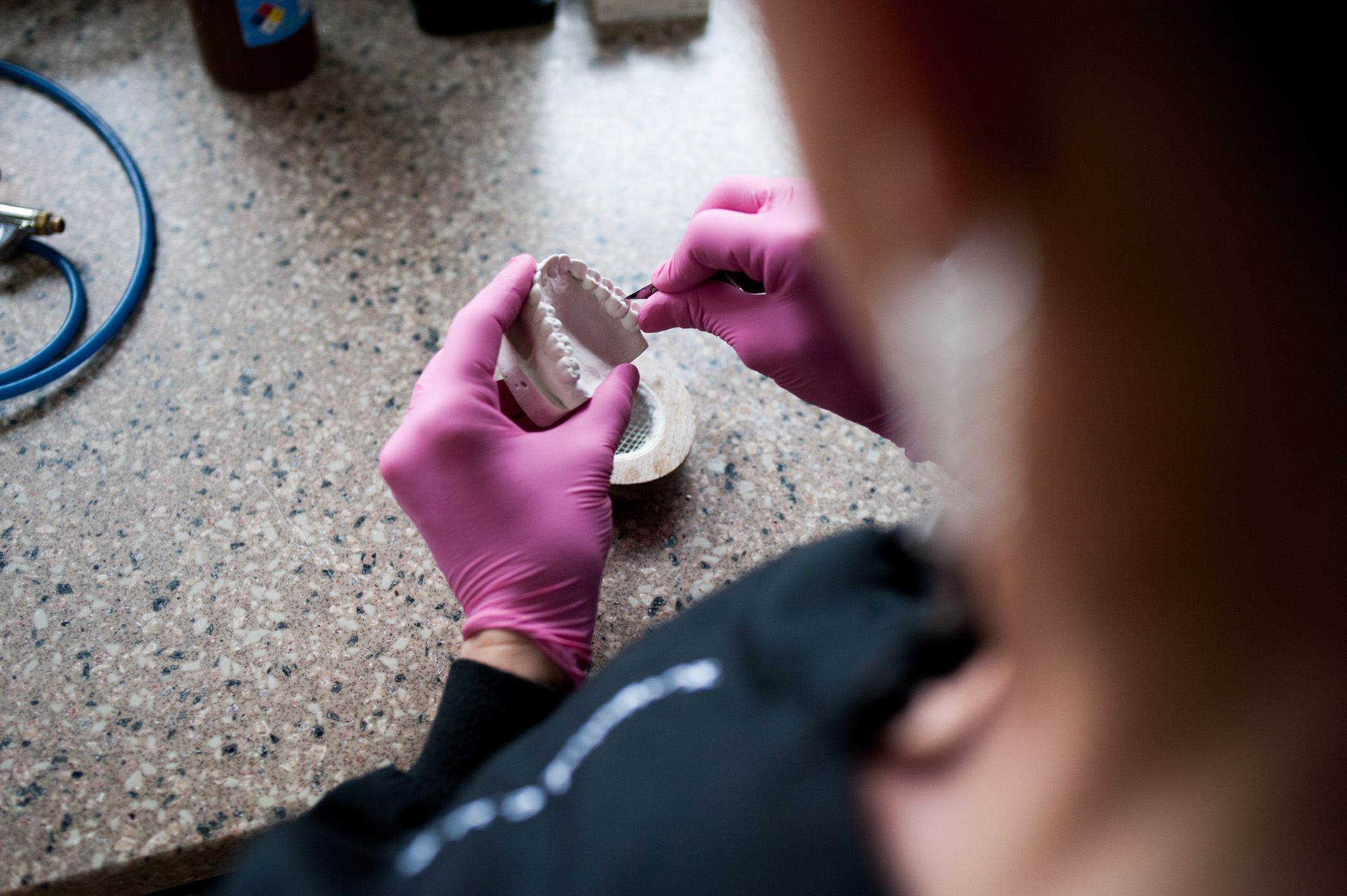 Cosmetic Dentistry Bay Village OH 44140, Smile Makeover Dentist, Dental Veneers Crowns Bridges